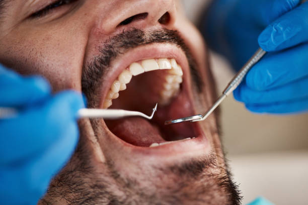 Best Same-Day Emergency Dentist in Mcarthur, OH